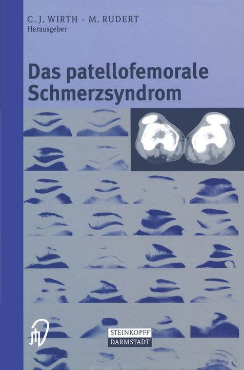 Produktbild Das patellofemorale Schmerzsyndrom (Deutsch, 2012)