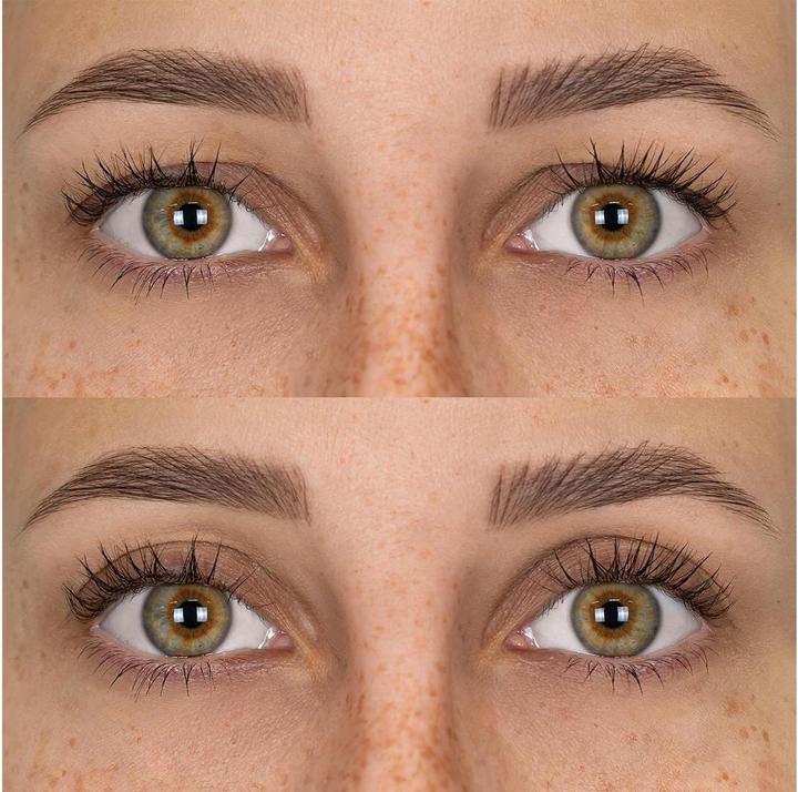 Actual product image Fleeky Magic Stripes stickers against drooping eyelids