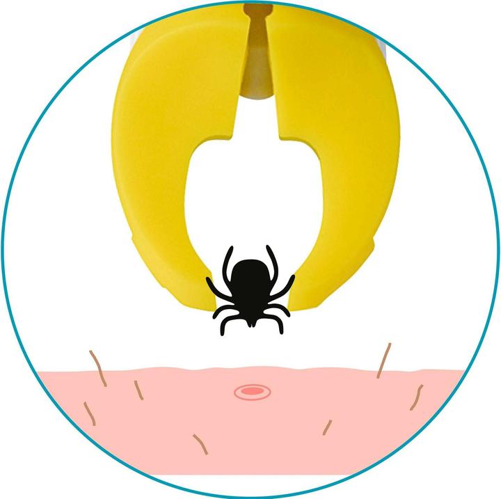 Actual product image TickSafe Rotating tick grabber (70 g)