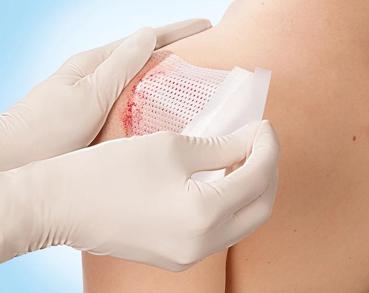 Produktbild BSN Cuticell Contact 5x7.5cm (5x)