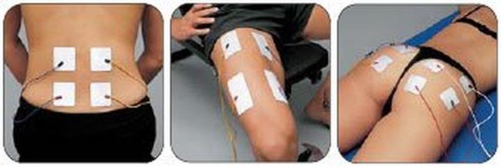 Actual product image I-Tech Mio-Care Tens