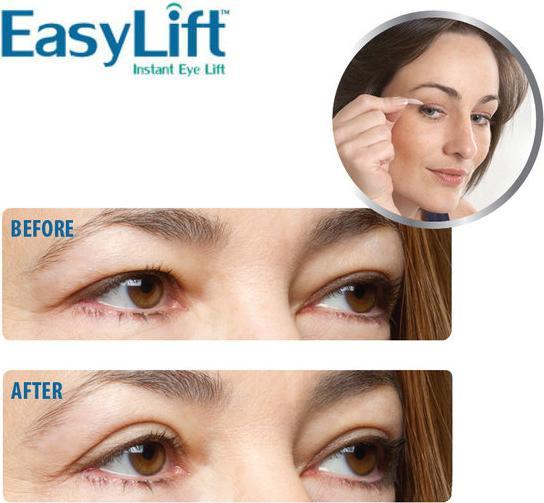 Produktbild Easy Lift Eyelid Stickers - Original (Patches)