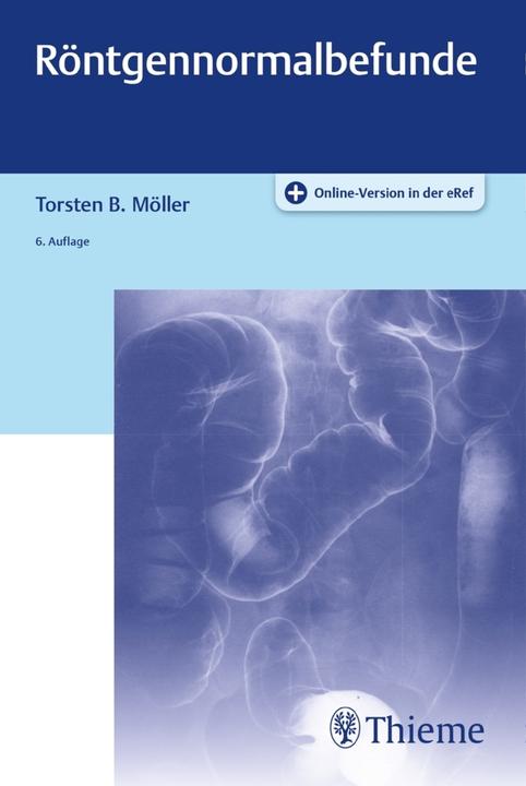 Produktbild Röntgennormalbefunde (Deutsch, Möller, TorstenBert, 2019)