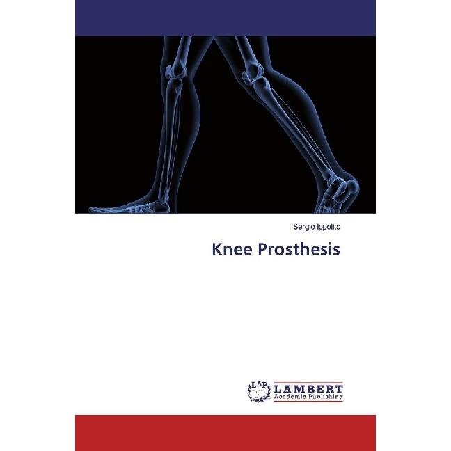Knee Prosthesis, Fachbücher von Sergio Ippolito