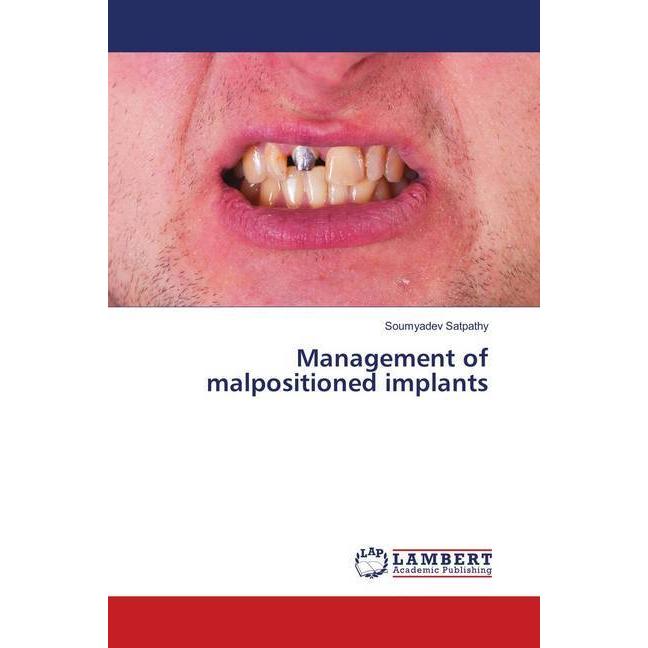 Management of malpositioned implants, Fachbücher von Soumyadev Satpathy