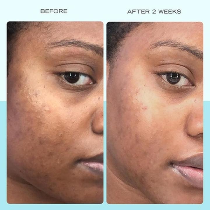 Immagine prodotto First Aid Beauty Siero per macchie scure con Niacinamide - Schiarisce le macchie scure