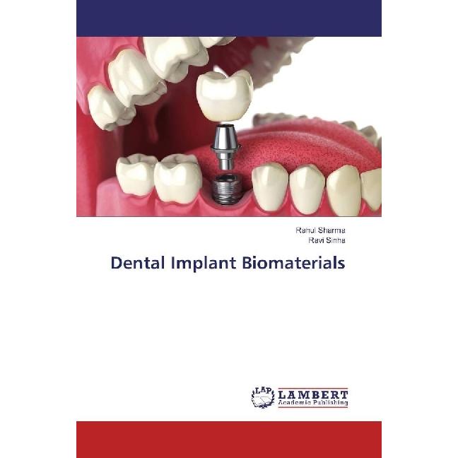 Dental Implant Biomaterials, Fachbücher von Rahul Sharma, Ravi Sinha