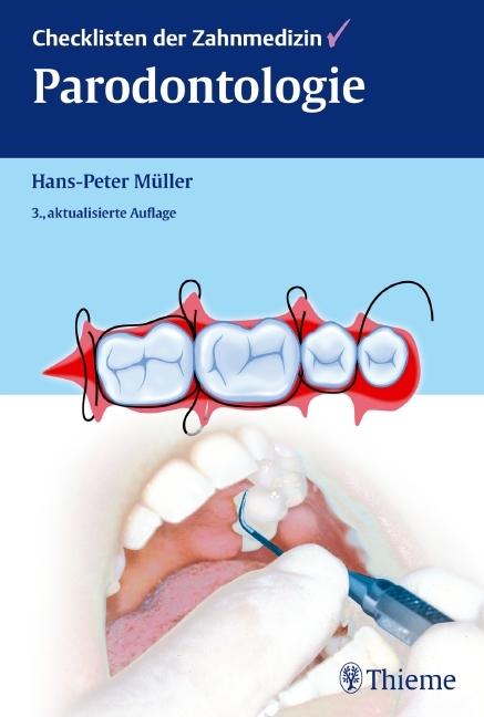 Produktbild Checklisten der Zahnmedizin Parodontologie (Deutsch, Hans-Peter Müller, 2012)