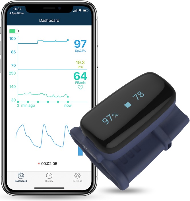 Actual product image ViatomTech Oxyfit