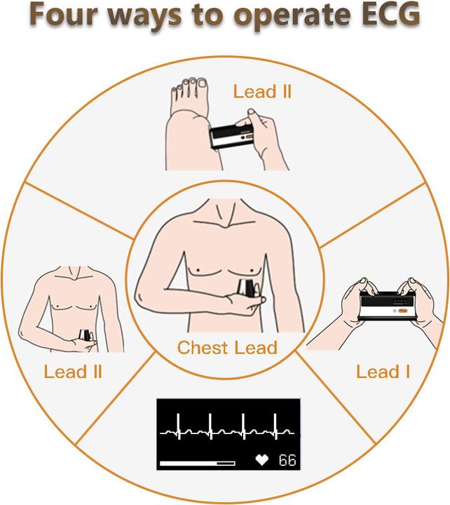 Produktbild ViatomTech Armfit