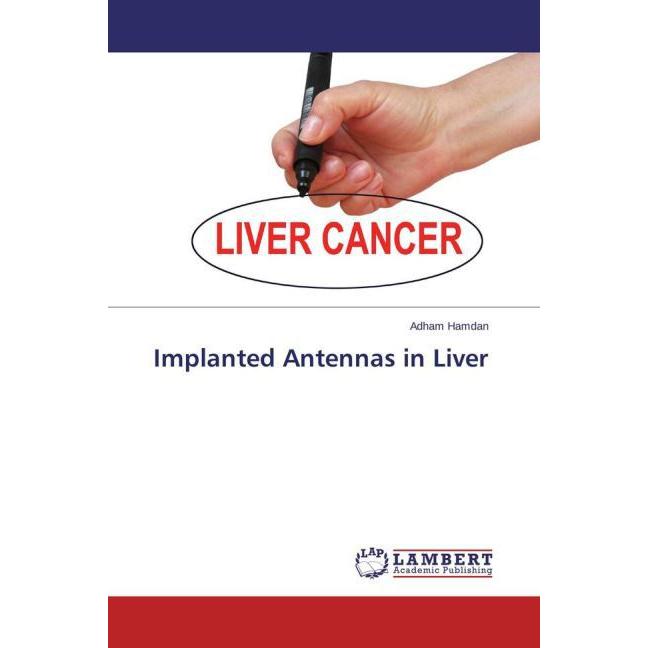 Implanted Antennas in Liver, Fachbücher