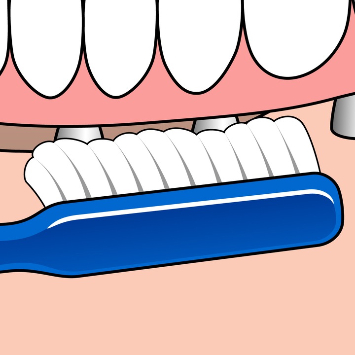 Actual product image TePe Implant / Orthodontic (Soft, 1 x)