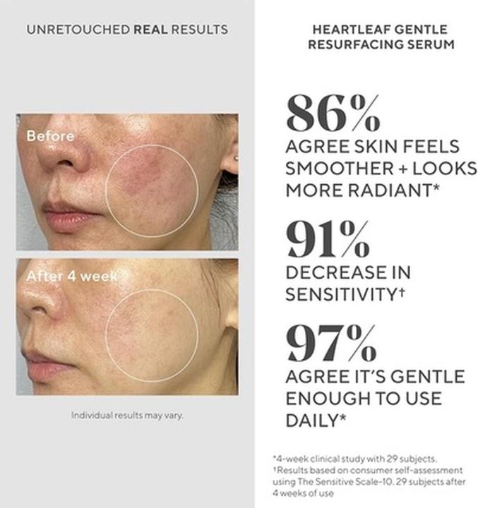 Actual product image Murad Heartleaf Gentle Resurfacing Serum (30 ml)