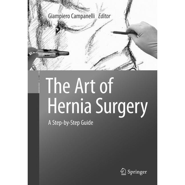 The Art of Hernia Surgery, Fachbücher von Giampiero Campanelli
