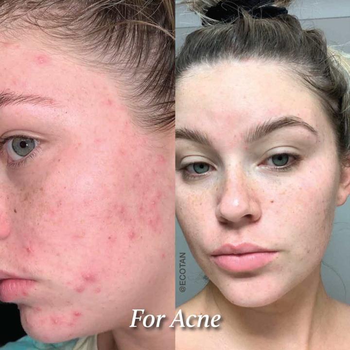 Actual product image Eco by Sonya Glory Oil (30 ml, Face oil)