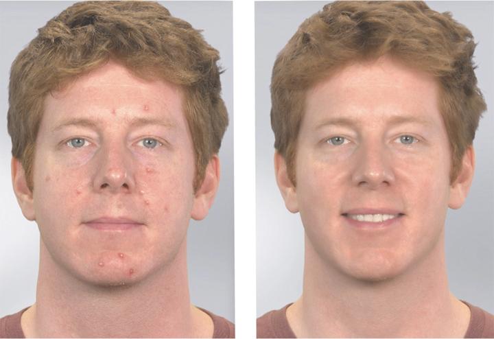 Actual product image MediaShop Derma Suction