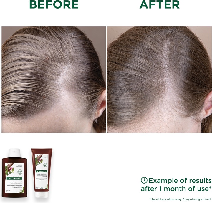 Produktbild Klorane Pflegebalsam (200 ml)