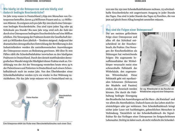 Produktbild In der Sprechstunde: Osteoporose (Deutsch, Tassilo König, 2024)
