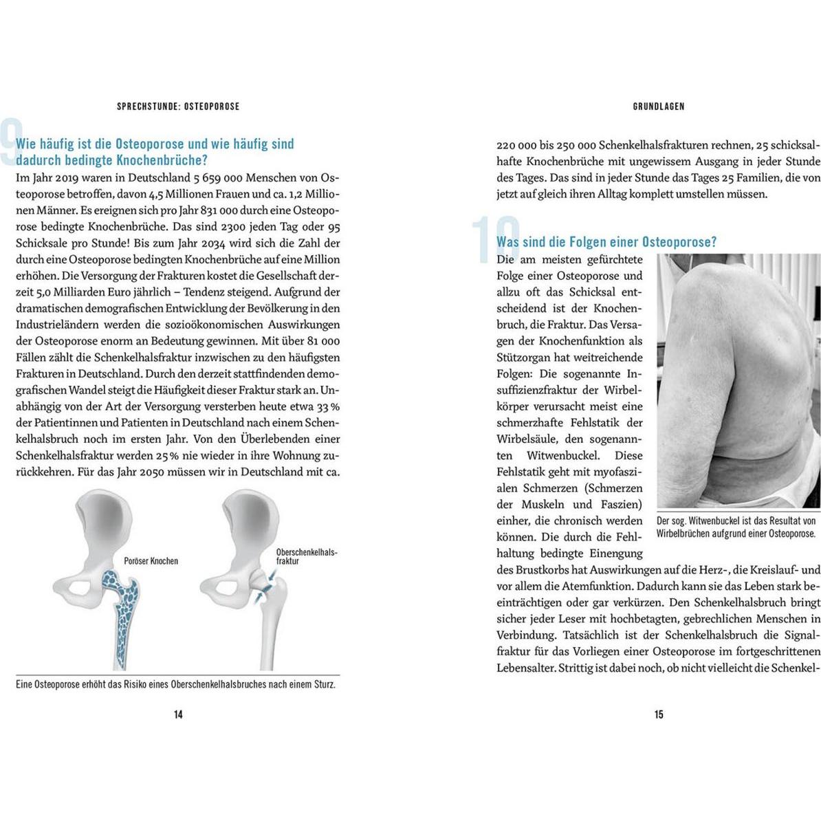 Thumbnail - In der Sprechstunde: Osteoporose, Ratgeber von Tassilo König