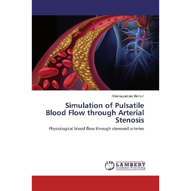 Simulation of Pulsatile Blood Flow through Arterial Stenosis, Fachbücher von Khairuzzaman Mamun
