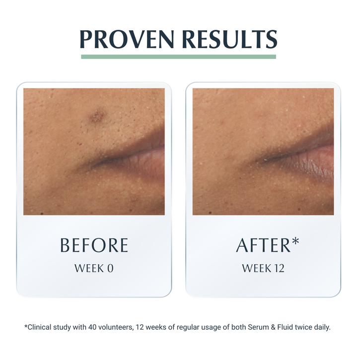 Produktbild Eucerin DermoPure Triple Action Serum (40 ml)