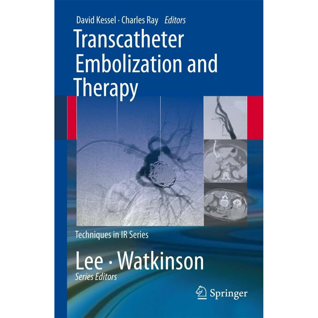Transcatheter Embolization and Therapy, Fachbücher von David Kessel, Charles Ray