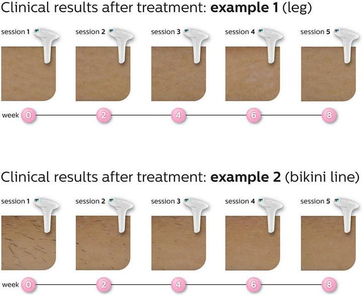 Produktbild Philips Lumea Advanced