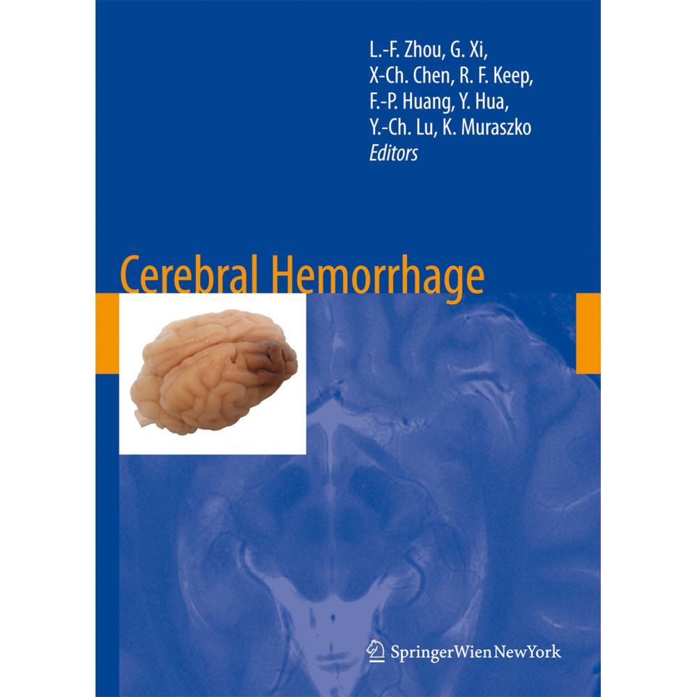 Cerebral Hemorrhage, Fachbücher von Guohua Xi, Karin Muraszko, Ya Hua, Yi-Cheng Lu, Xian-Cheng Chen, Richard F. Keep, Li...