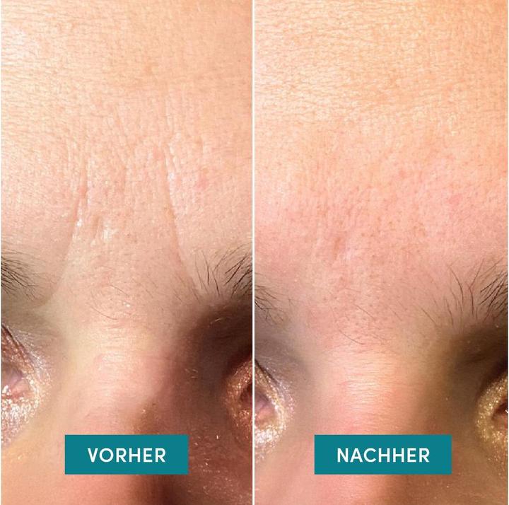 Actual product image Apricot Down The Frown