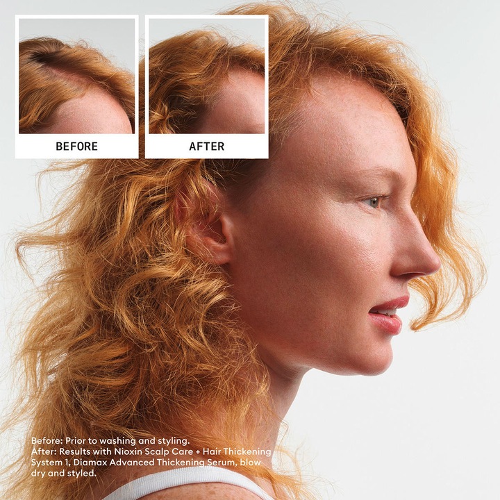Actual product image Nioxin Starter Set 1, 2x/1x50ml (350 ml, Liquid shampoo)