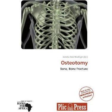 Osteotomy, Fachbücher von Janeka Ane Madisyn