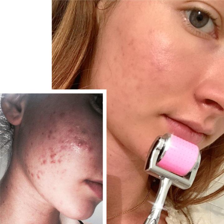 Actual product image Âme pure CIT Face Roller Platinum