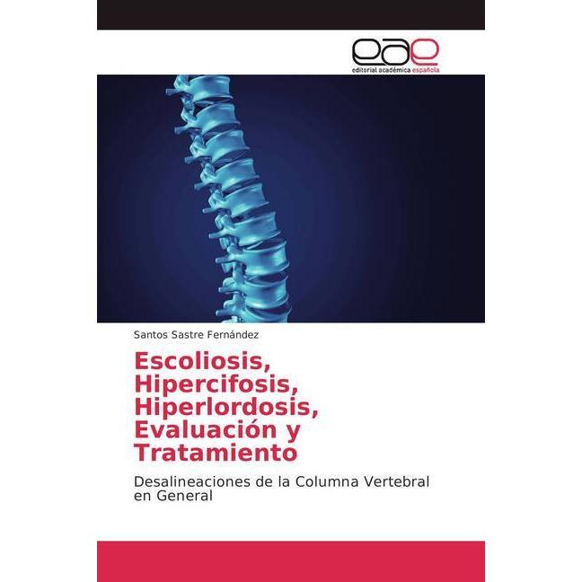 Escoliosis, Hipercifosis, Hiperlordosis, Evaluación y Tratamiento, Fachbücher von Santos Sastre Fernández