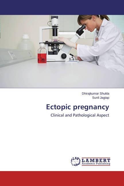 Immagine prodotto Ectopic pregnancy (Sunil Jagtap, Dhirajkumar Shukla, 2015)