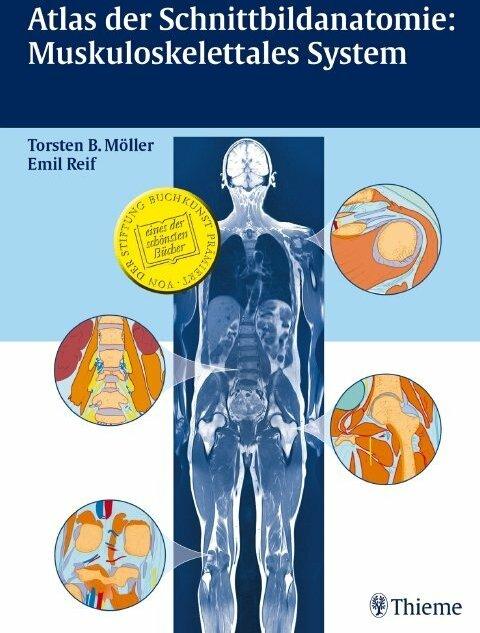 Actual product image Atlas der Schnittbildanatomie: Muskuloskelettales System (German, Emil Rime, Torsten Bert Möller, 2008)