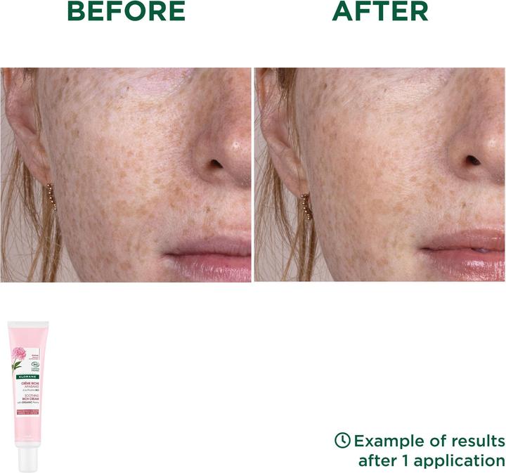 Image du produit Klorane Crème riche et apaisante à la pivoine BIO (40 ml, Crème 24h)
