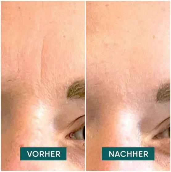 Produktbild Apricot Anti-Falten-Gesicht Patches Hyaluron (96 ml)