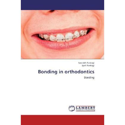 Bonding in orthodontics, Ratgeber von Jyoti Rastogi, Saurabh Rastogi