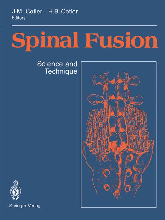 Produktbild Spinal Fusion (Englisch, Howard B. Cotler, Jerome M. Cotler, 2012)