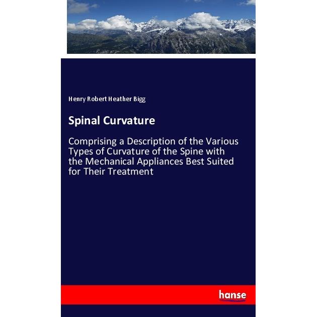 Spinal Curvature, Fachbücher von Henry Robert Heather Bigg