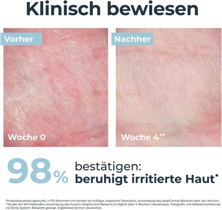 Produktbild Eucerin AtopiControl (200 ml)