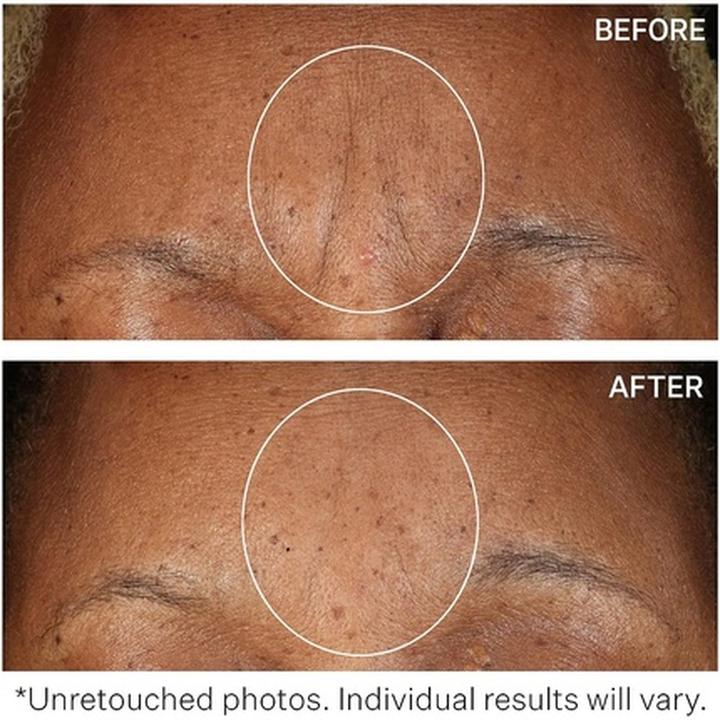 Immagine prodotto StriVectin Antirughe (60 ml)