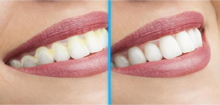 Actual product image MediaShop Tooth cleaning system (Toothbrush steriliser)