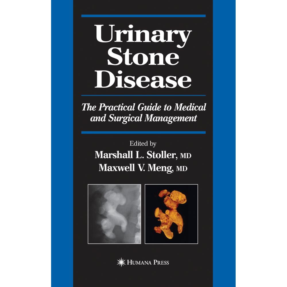 Urinary Stone Disease, Fachbücher von Maxwell V. Meng, Marshall L. Stoller
