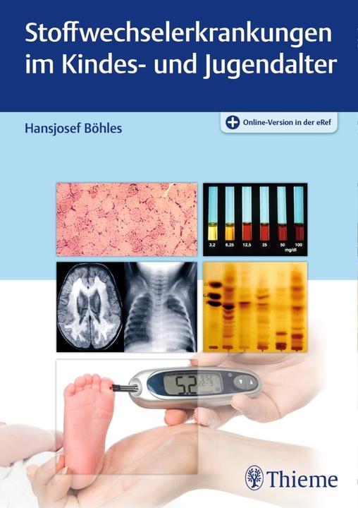 Produktbild Stoffwechselerkrankungen im Kindes- und Jugendalter (Deutsch, Hansjosef Böhles, 2016)
