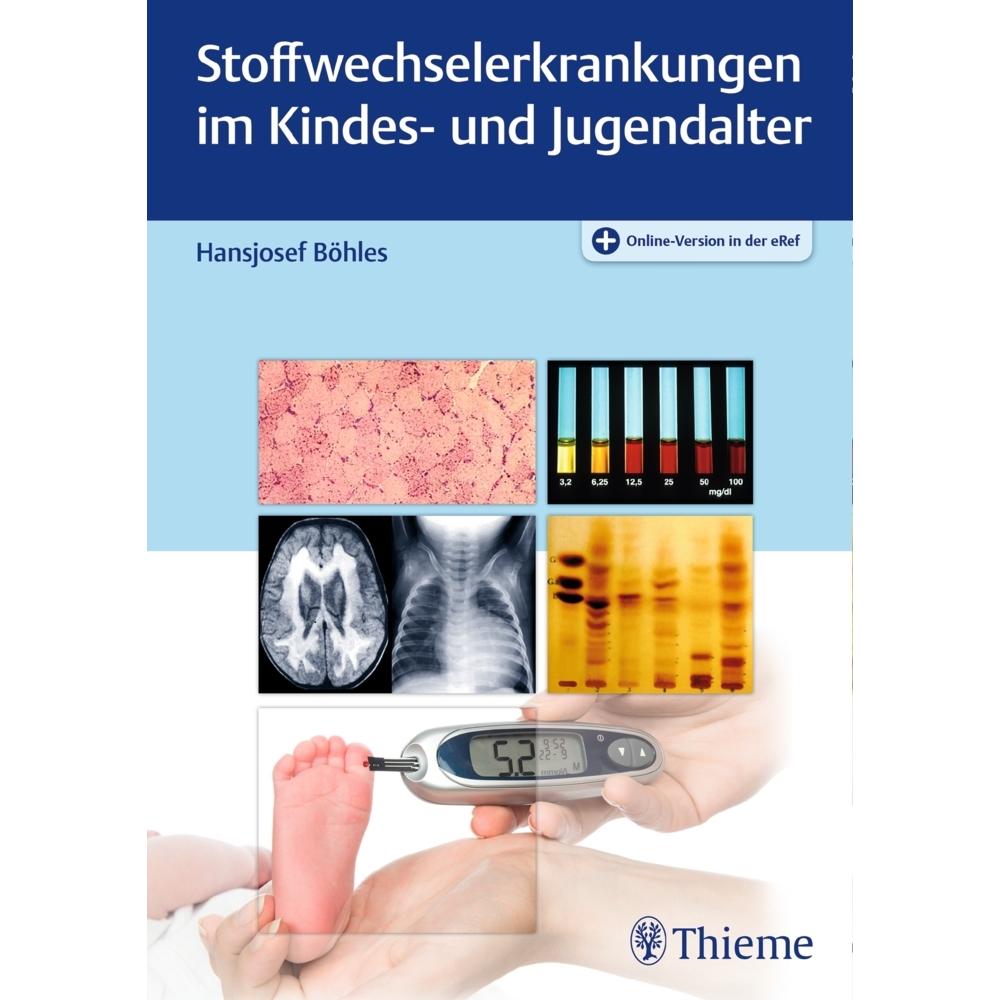 Stoffwechselerkrankungen im Kindes- und Jugendalter, Fachbücher von Hansjosef Böhles