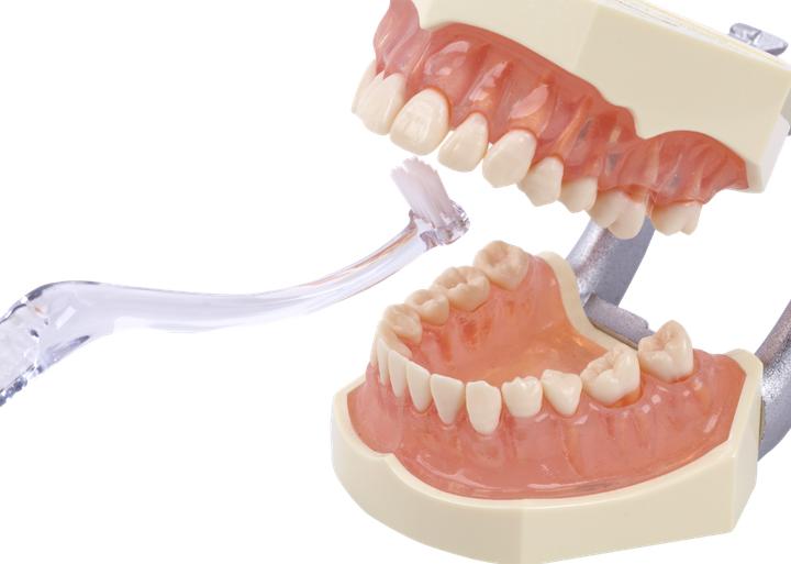Productafbeelding Dentaid Vitis Implantaat Hoekig (1 x)