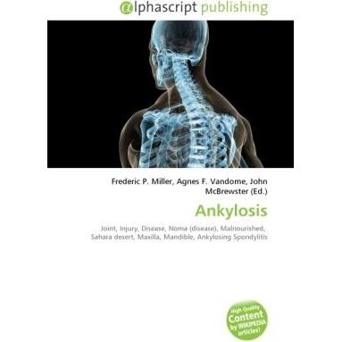 Ankylosis, Fachbücher von Agnes F. Vandome, Frederic P. Miller, John McBrewster