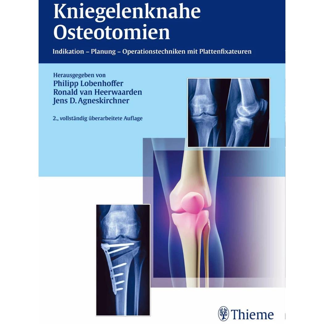 Kniegelenknahe Osteotomien, Fachbücher von Philipp Lobenhoffer, Jens Agneskirchner, Ronald van Heerwaarden