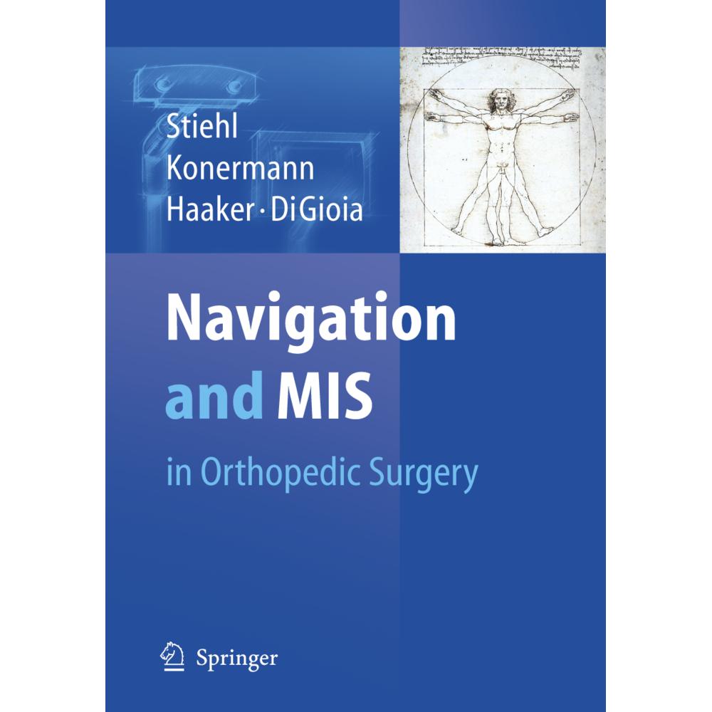 Navigation and MIS in Orthopedic Surgery, Fachbücher von James B. Stiehl, Rolf G. Haaker, A. M. DiGioia, Werner H. Koner...
